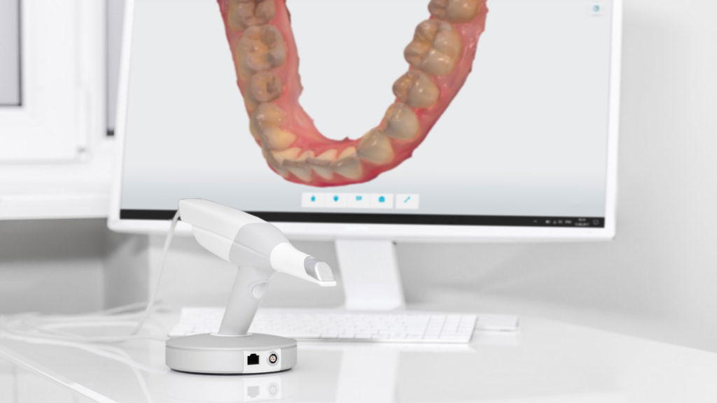 Dentiste Athis-Mons - Empreinte optique