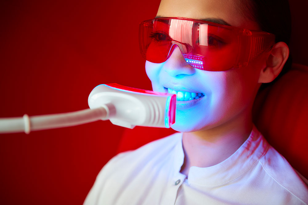 Dentiste Athis-Mons - Eclaircissement dentaire