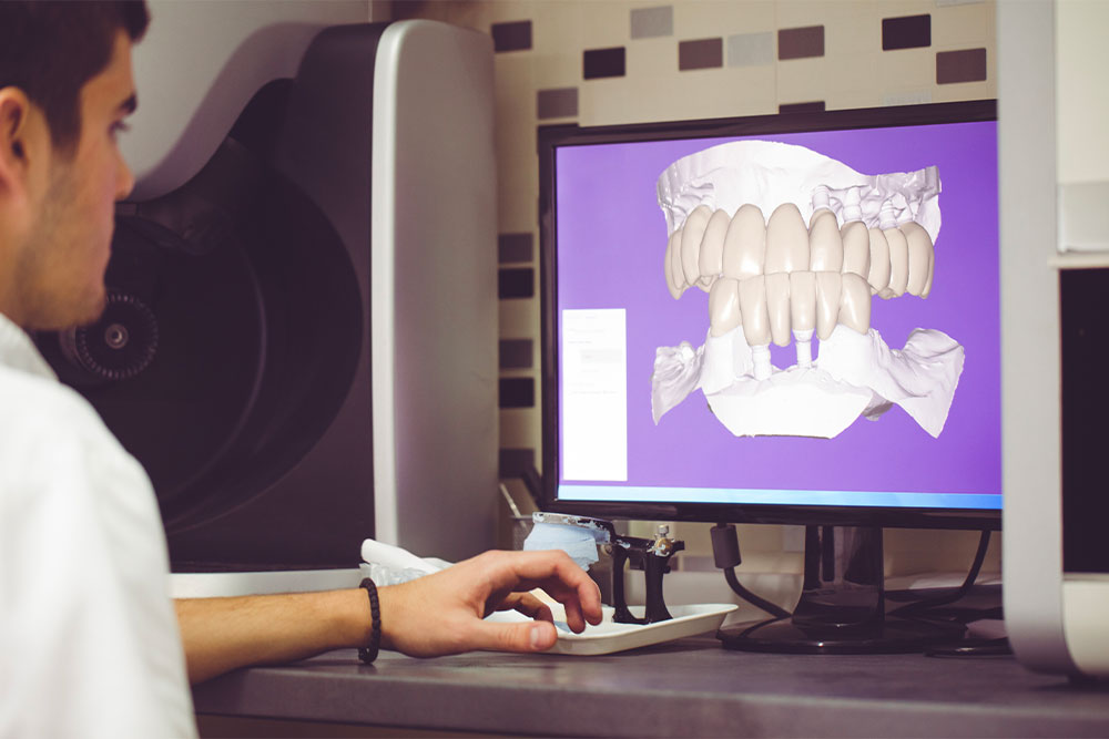 Dentiste Athis-Mons - Implant dentaire