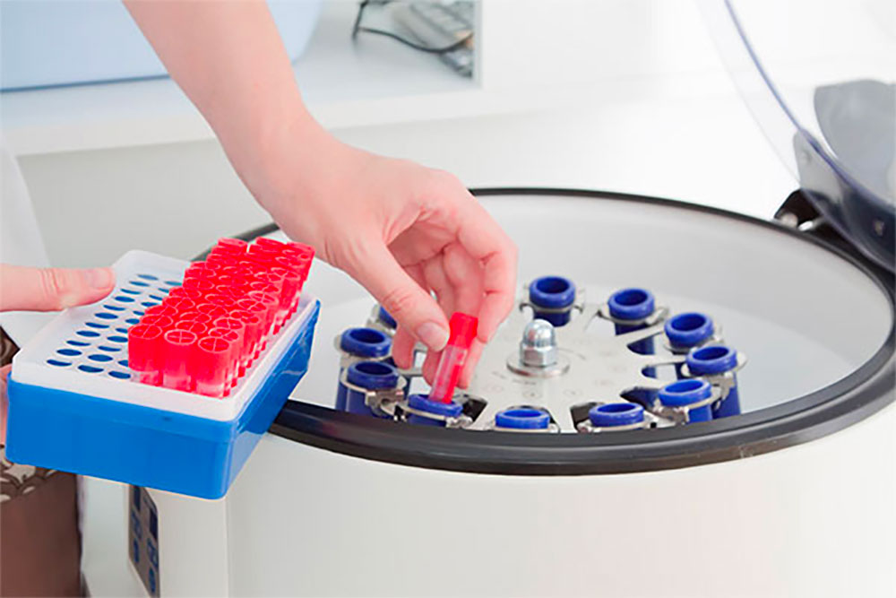 Dentiste Athis-Mons - PRF